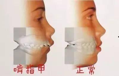 啃指甲吃瓜,揭秘现代人的焦虑与娱乐